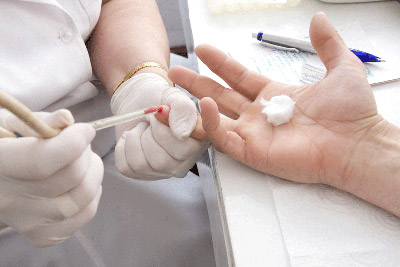 Скористайтися своїм правом на гарантовану державою послугу та пройдіть тест на вірусні гепатити